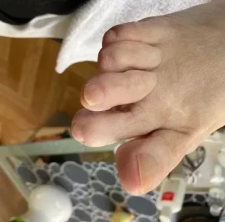 Pedicure