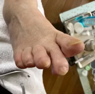 Pedicure